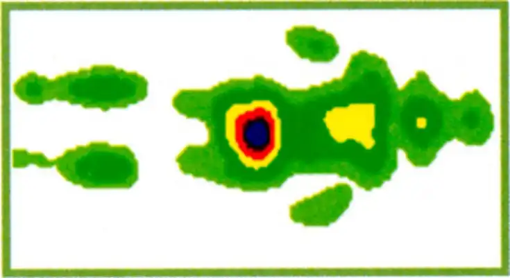 体圧分散のサーモグラフ（腰に負担がかかっている状態）